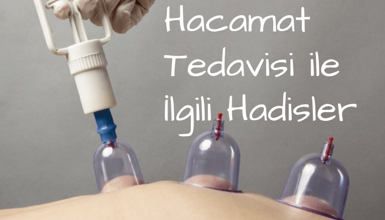 Hacamat tedavisi ile ilgili hadisler